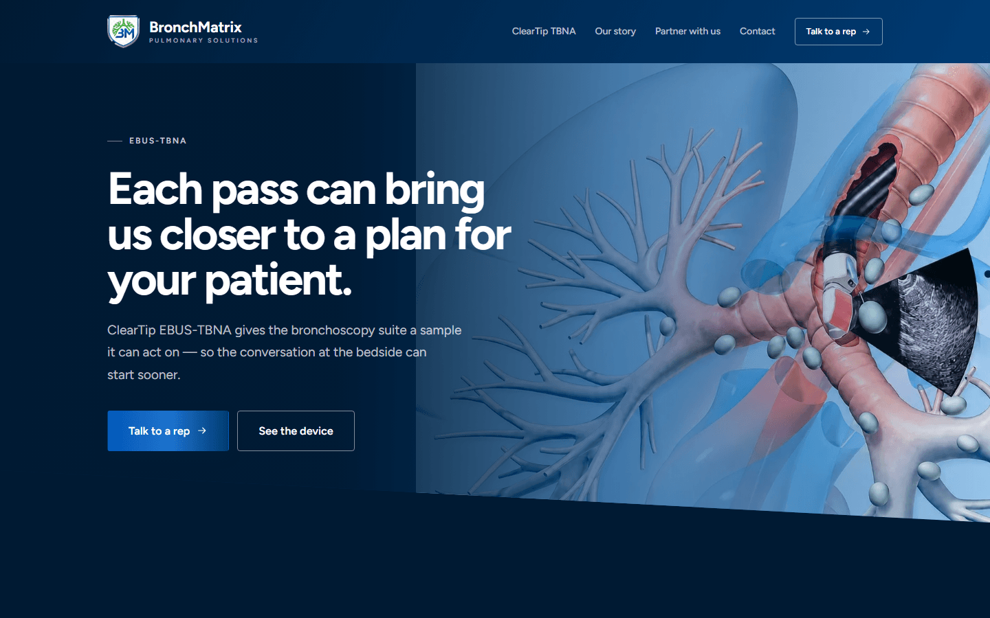 BronchMatrix homepage built by Digital Elevator