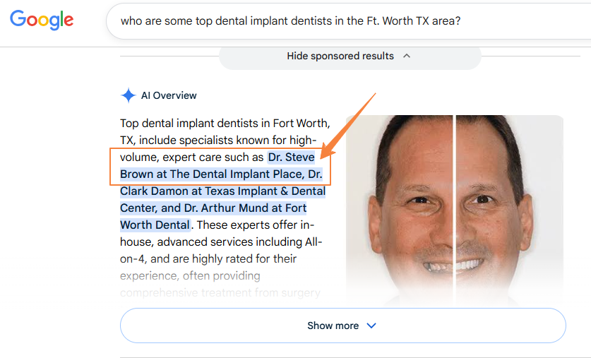 Google AI Overviews citing Dr. Steve Brown at The Dental Implant Place as a top dental implant dentist in Fort Worth, TX